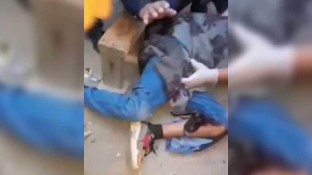 Sabunçu rayonunda velosiped 12 yaşlı oğlanın ayağını kəsib