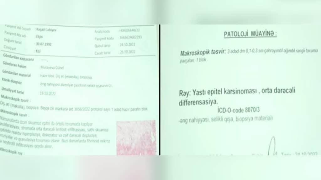 "City Hospital"da pasiyentə xərçəng diaqnozu qoyulub: Türkiyədə isə xəstəyə başqa cavab verilib