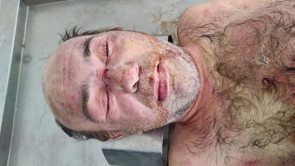 Mərdəkanda naməlum kişi meyiti tapılıb