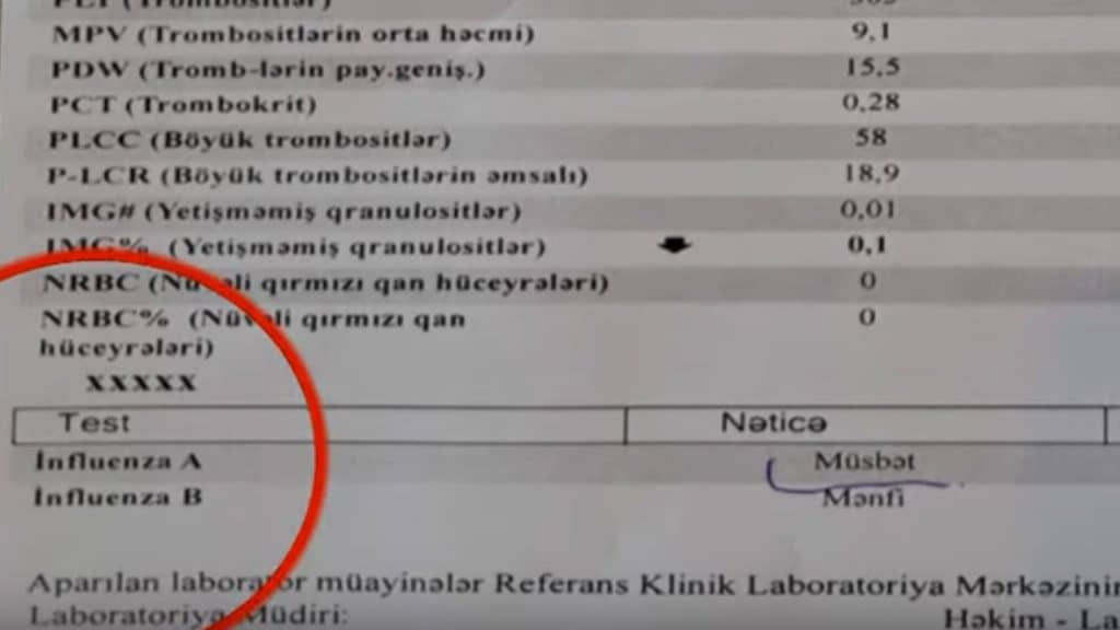 virus yayılır