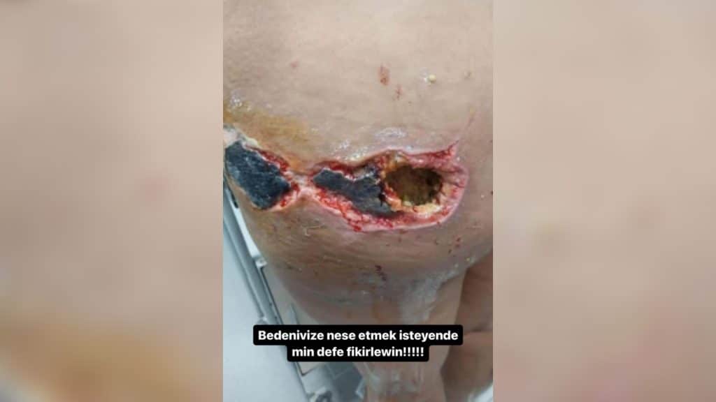 Bloger Leyla Mirzəliyeva son vəziyyətindən danışıb – FOTO