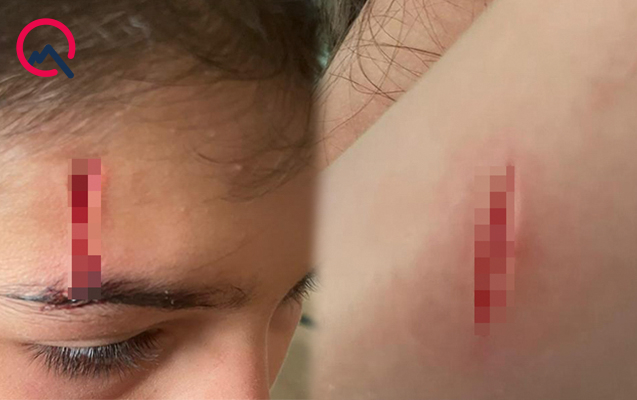 Baxımsız qalan şüşə qırıqları uşağın xəsarət almasına səbəb olub