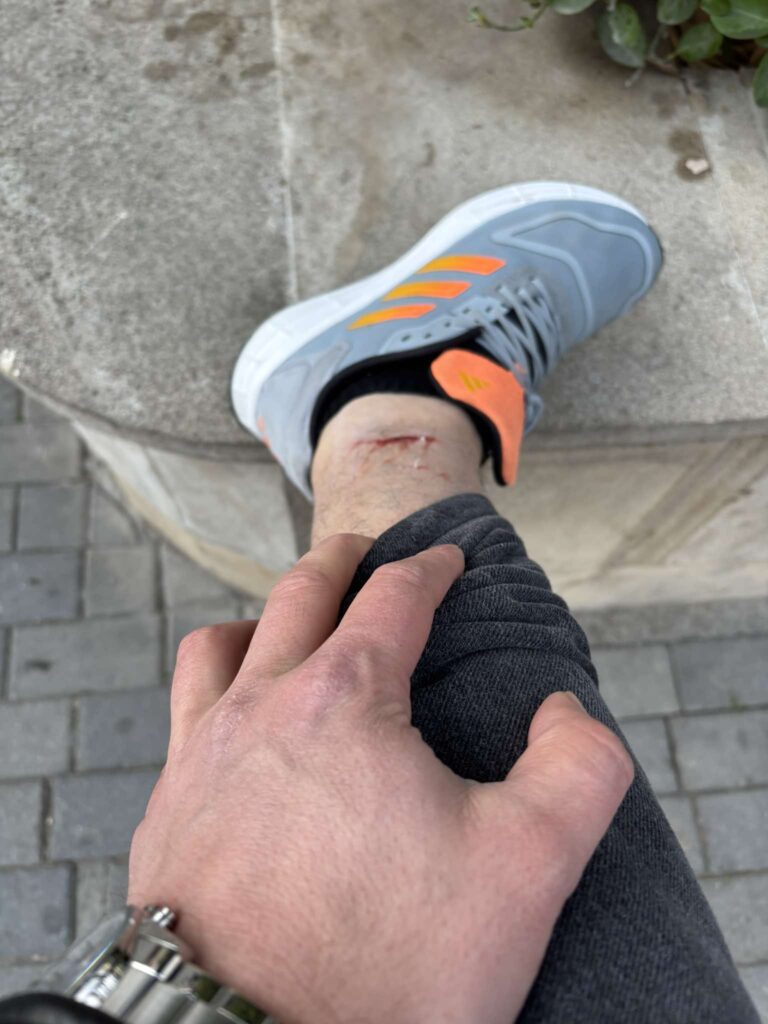 İtlər jurnalistə hücum çəkdi