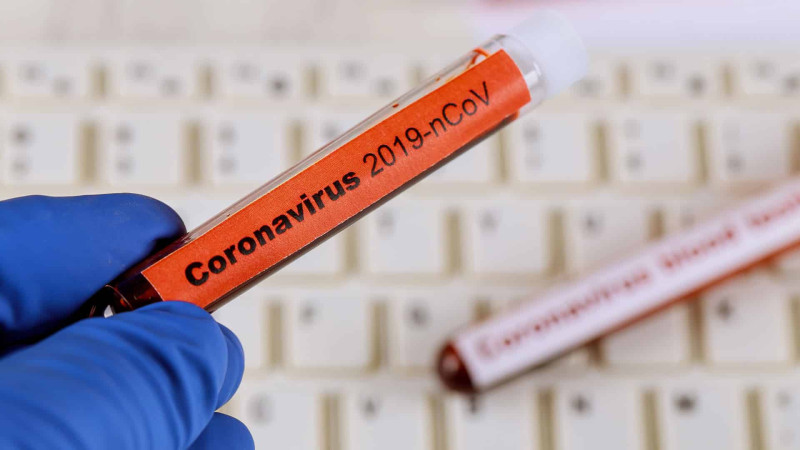 Bakıda gün ərzində 4 koronavirus xəstəsi saxlanılıb