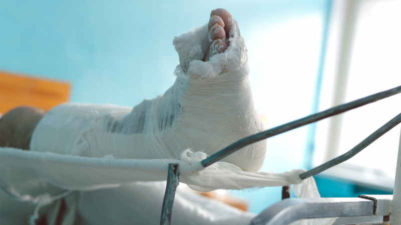 Nərimanov rayonunda yol qəzası: motosikletçi xəsarət alıb