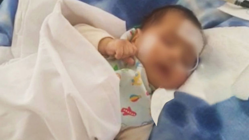 Bir həftədir komada olan üç aylıq körpənin həyatı xilas edilib
