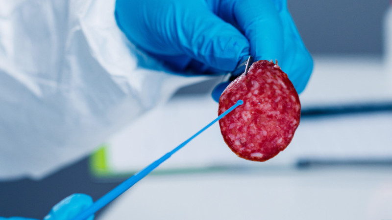 Nərimanov rayonunda 2 tələbə kolbasadan zəhərlənib