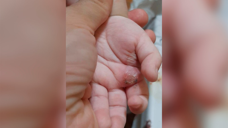 Bakıda 2 yaşlı körpəyə işgəncə verən valideynlər nəzarət altına götürülüblər
