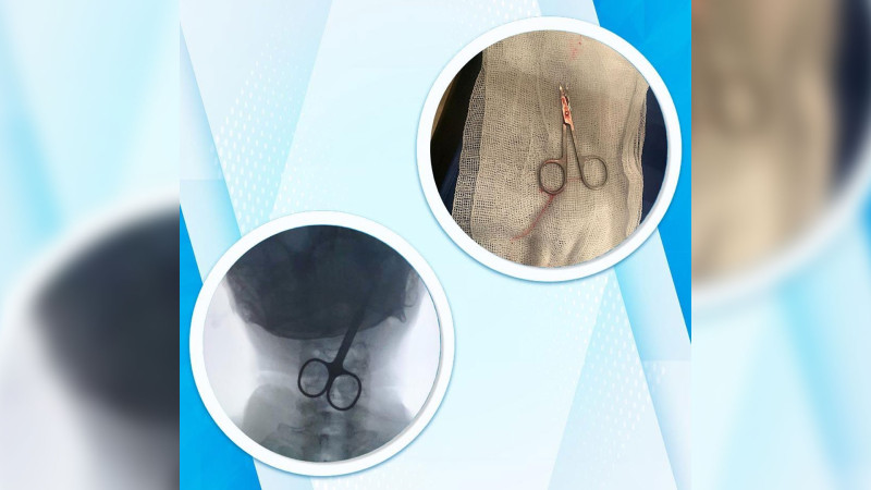 Bakıda qayçı udan şəxsin vəziyyəti orta ağır qiymətləndirilir