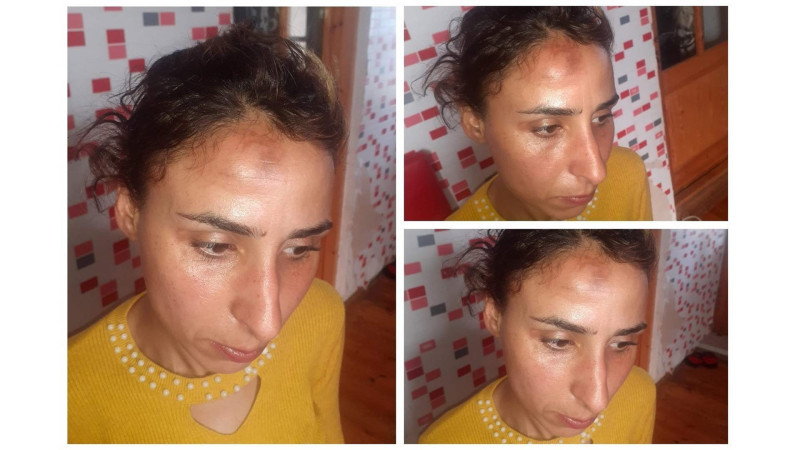 Türkan qəsəbə sakini sərnişin avtobusunda döyülüb