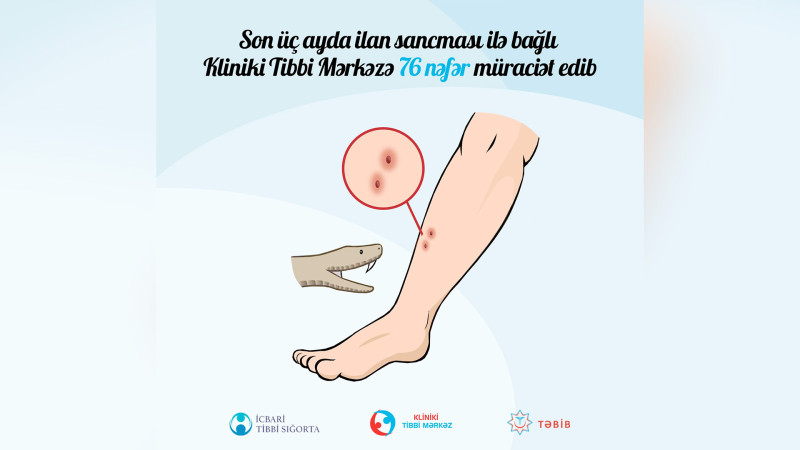 Kliniki Tibbi Mərkəzə neçə nəfər ilan sancması ilə müraciət edib?