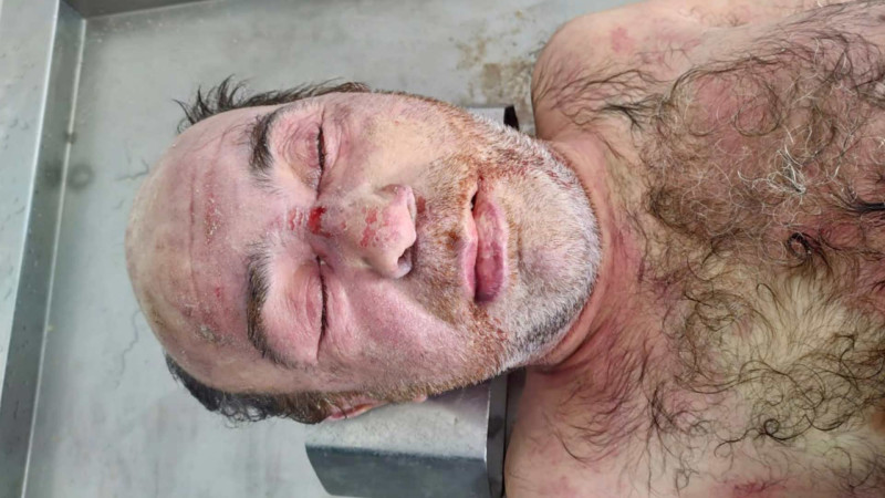 Mərdəkanda naməlum kişi meyiti tapılıb - FOTO