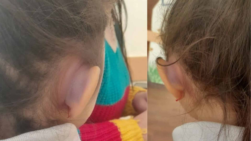 Abşeron rayonunda 7 yaşlı qız işgəncəyə məruz qalıb
