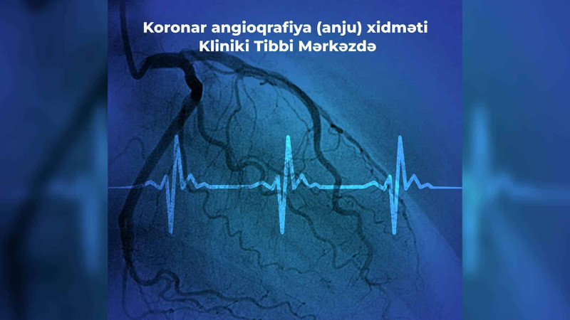 Kliniki Tibbi Mərkəzdə yeni xidmət göstəriləcək