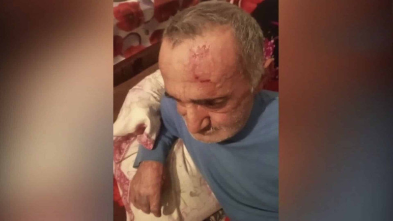 Bakının qəsəbəsində gənc oğlan atasını şiddətlə döyüb