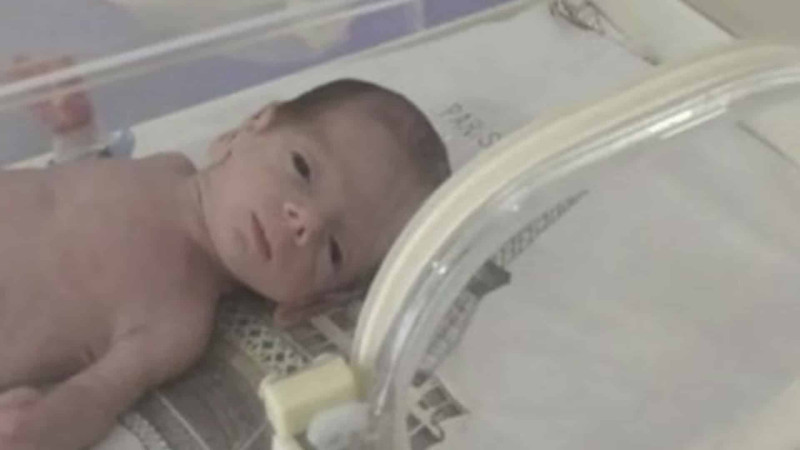 Respublika Perinatal Mərkəzində 845 qramlıq körpə dünyaya gəlib