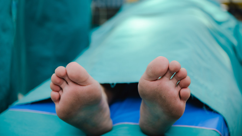 Xəzər rayonunda kimyavi maddə içən kişi vəfat edib