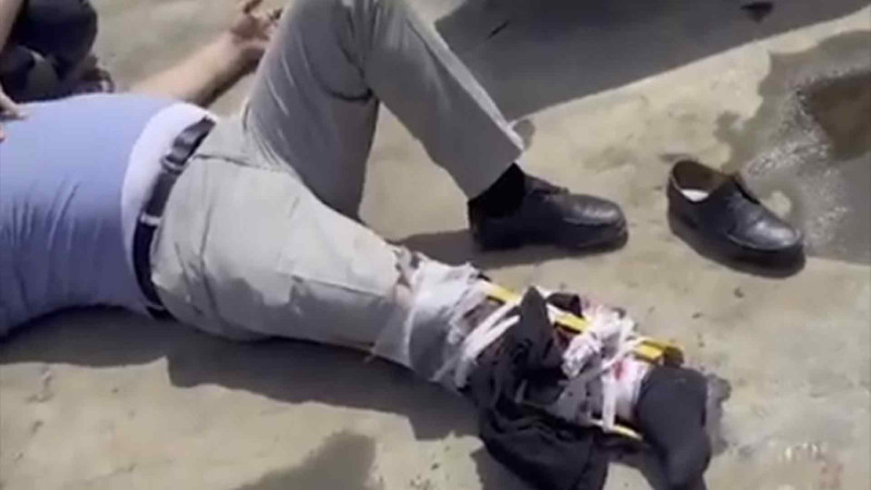 Bakıda 63 yaşlı kişi damdan düşürülərək xilas olunub – VİDEO