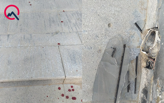 Baxımsız qalan şüşə qırıqları uşağın xəsarət almasına səbəb olub