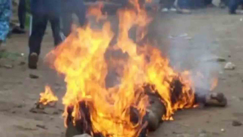 Zirədə kişi ocağa yıxılaraq yanıb