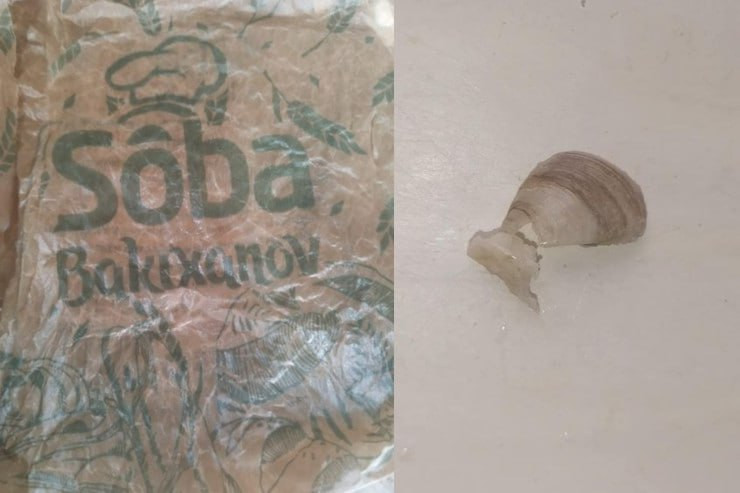 Çörəyinin içindən çıxan balıqqulağı uşağın damağını kəsdi