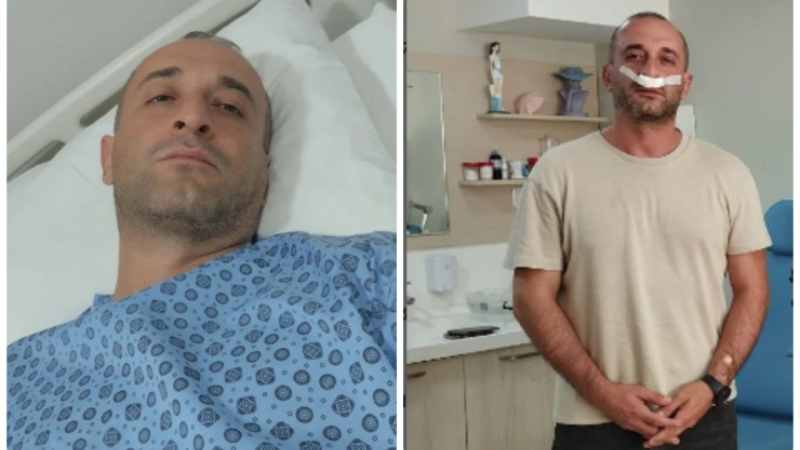 Tanınmış aktyor əməliyyat olundu