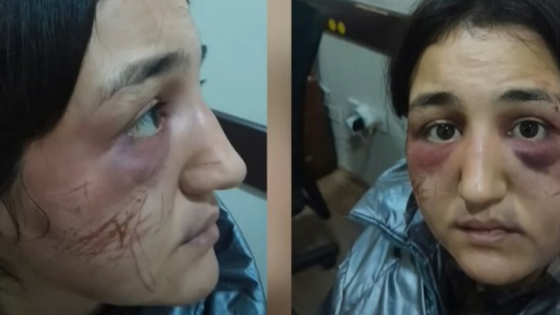 Paytaxtda DƏHŞƏT: 24 yaşlı qadın amansızca döyülüb evdən qaçdı - FOTO/VİDEO