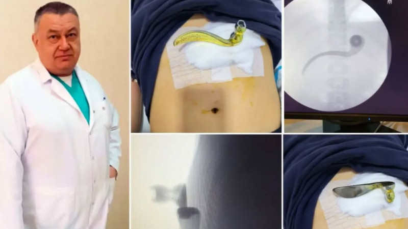 10 yaşlı uşağın qarın boşluğuna qapı dəstəyi məktəbdə BATIB – Hadisənin TƏFƏRRÜATI
