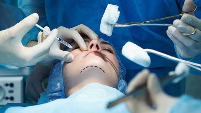 Diplomsuz plastik cərrahlarla bağlı 18 FAKT aşkar edildi - RƏSMİ