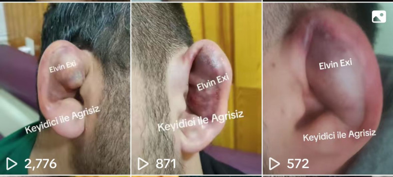 Bakıda qulaq sındırırlar! Özü də pulla - VİDEO