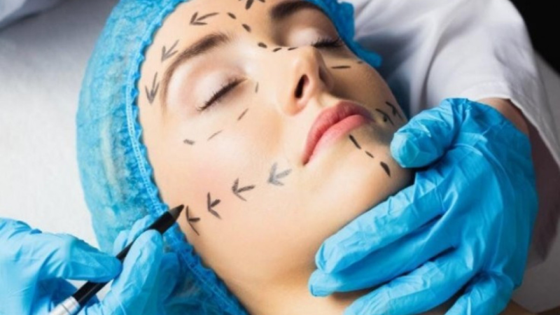 82 plastik cərrah sənədlərini nazirliyə təqdim etdi 