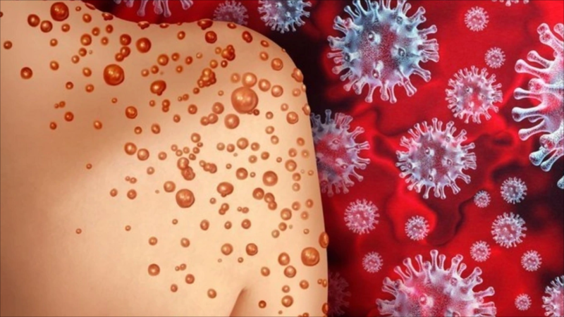 Meymunçiçəyinin əsas əlamətləri və qorunma yolları - RƏSMİ