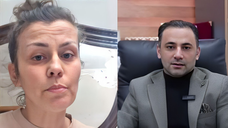 Bakıda qadın bud əməliyyatına girdi, burnunu KƏSDİLƏR 