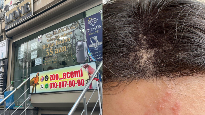 Gözəlləşməyə getdi, başını ütdülər - ŞİKAYƏT + FOTO