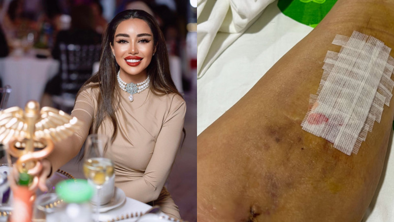 Kosmetoloqun 10 il davam edən zülmü - İDDİA + VİDEO 