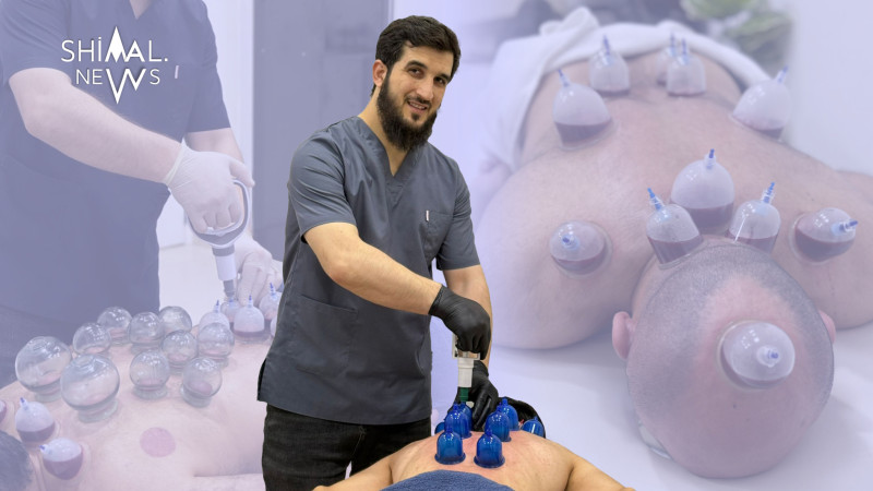 “İki xərçəng xəstəsi hicama ilə sağaldı” – Haldun Məmmədli ilə MÜSAHİBƏ