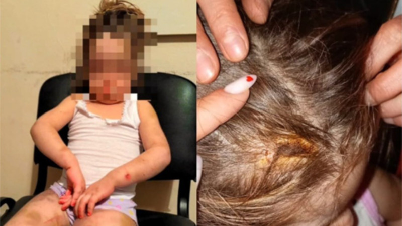 Övladına işgəncə verən ana saxlanılıb, cinayət işi başlanılıb- YENİLƏNİB