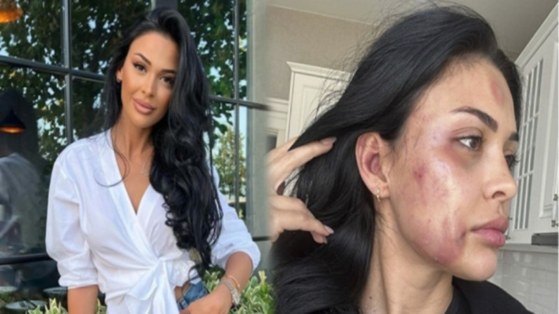 Tanınmış modeli döyməkdə təqsirləndirilənə hökm oxundu