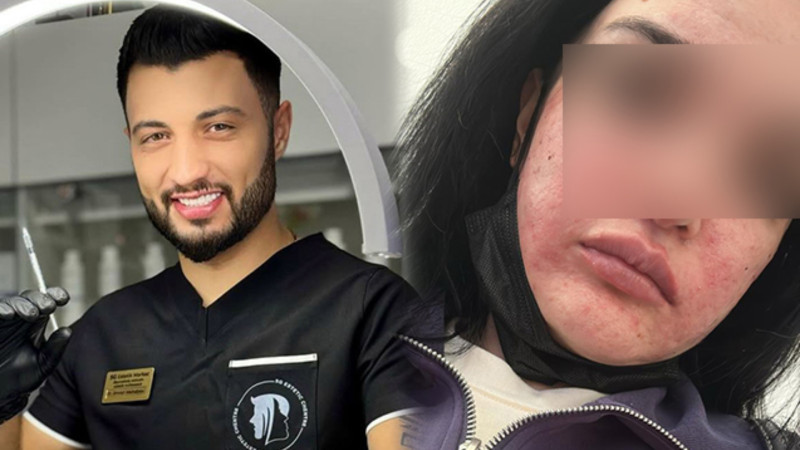 “Prosedurdan sonra mənə dedilər ki, o həkim yox, bərbərdir” - Zərərçəkmiş 