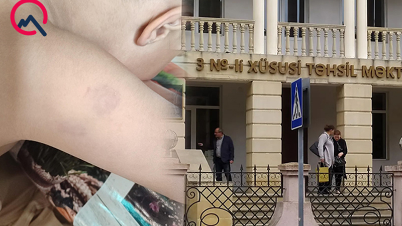 Xüsusi məktəbdə müəllim azyaşlıya şiddət göstərib? - Rəsmi açıqlama - Foto