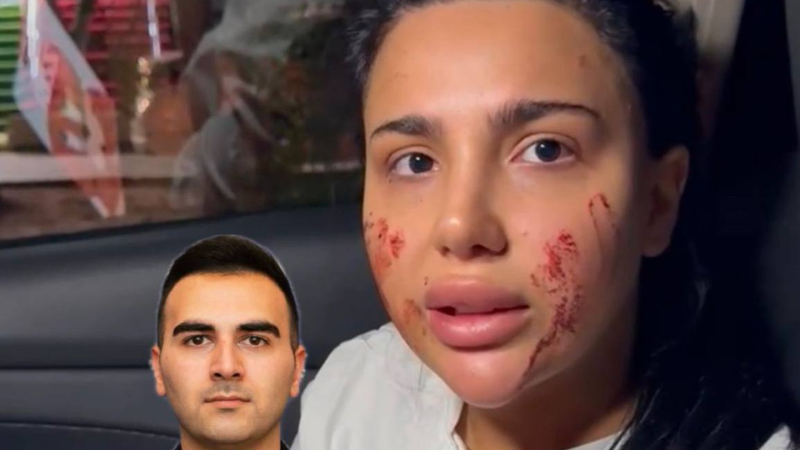 Bakıda sevdiyi oğlandan ayrılan qadına bıçaqlı hücum