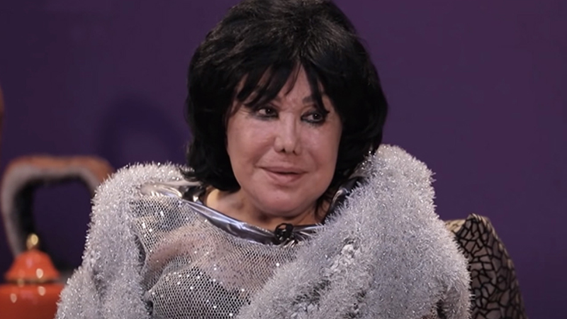 “Flora Kərimovaya da elə bu lazım idi” – Plastik cərrah qalmaqalı “Flora Kərimovaya da elə bu lazım idi” – Plastik cərrah qalmaqalı