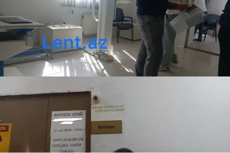 Binə xəstəxanasında hərc-mərclik - Rentgen otağına 5 nəfər daxil olur