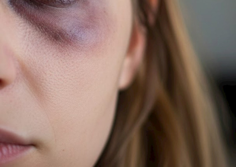 Keçmiş ərinə niyə evə gec gəlmisən dedi, döyüldü - Xırdalanda