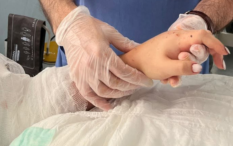 Bakıda qızın qopmuş qolu yerinə bərpa olundu