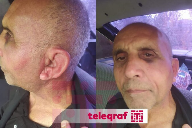 Psixiatriya Xəstəxanasında pasiyentin döyülməsi iddiasını polis araşdırır - RƏSMİ AÇIQLAMA