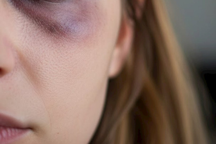 Gecə 1-də sevgilisini döydü — Söyüşə görə...