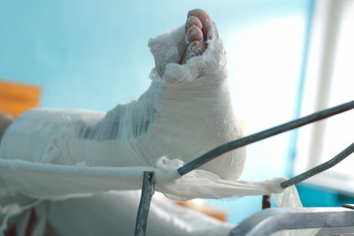 Nərimanov rayonunda yol qəzası: motosikletçi xəsarət alıb