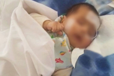 Bir həftədir komada olan üç aylıq körpənin həyatı xilas edilib