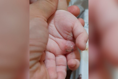 Bakıda 2 yaşlı körpəyə işgəncə verən valideynlər nəzarət altına götürülüblər